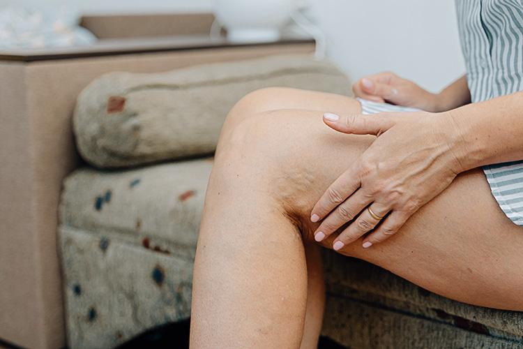 vadgesztenye kivonat,fáradt lábak,vadgesztenye krém,visszér